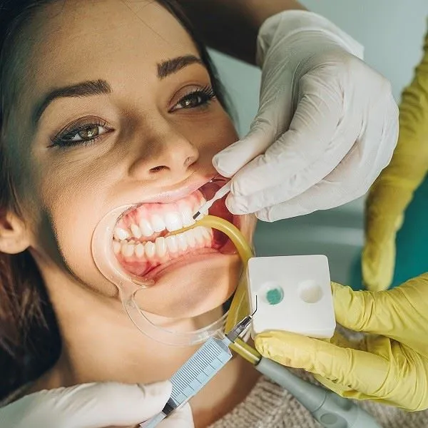 Dental Syringe Tips
